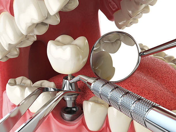 Best Walk-In Emergency Dental Services in Acton, CA