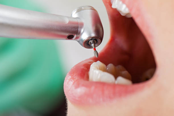 Best Emergency Treatment for Jaw Pain or Injury in Acton, CA